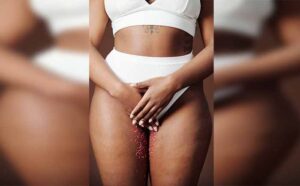 Bacterial Vaginosis si biang kerok keputihan tanpa gatal
