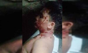 kondisi salah satu korban pengeroyokan di buleleng