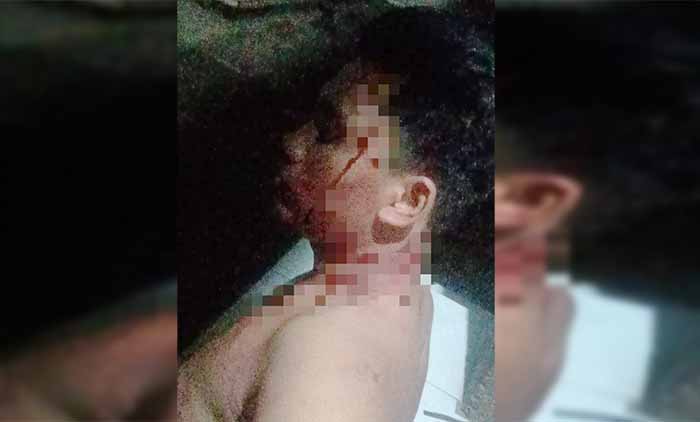 kondisi salah satu korban pengeroyokan di buleleng