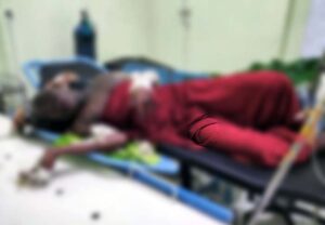 Korban Bakar, La Jumali terbaring kesakitan di ruang RSUD Kota Masohi