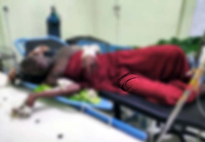 Korban Bakar, La Jumali terbaring kesakitan di ruang RSUD Kota Masohi