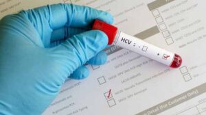 ilustrasi hepatitis