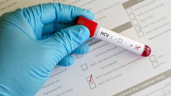 ilustrasi hepatitis