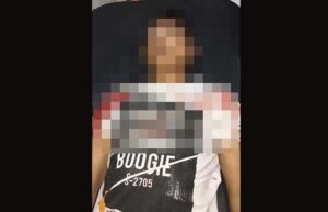 Kondisi Korban tabrakan di Halong Atas, setelah tiba di rumah sakit Bhayangkara Tantui Ambon.