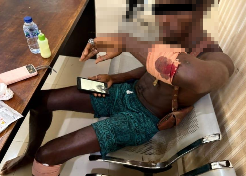 WNA Amerika korban pengeroyokan di Pecatu, Badung, Bali. (Foto: Istimewa)